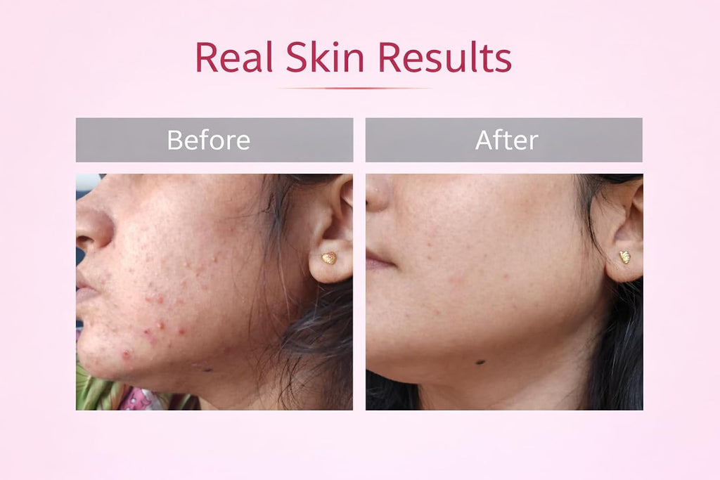 Anua Niacinamide 10+ TXA 4 Serum 30ML